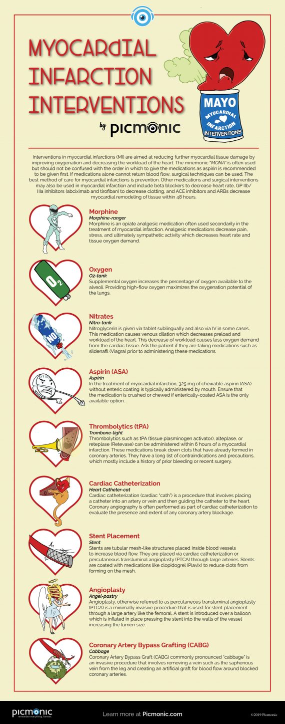 [Infographic] How to Study: Myocardial Infarction Interventions | Picmonic