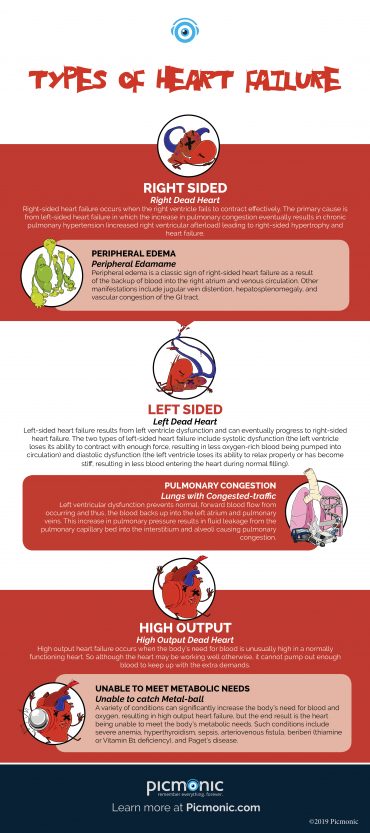 [Infographic] How to Study: Types of Heart Failure | Picmonic