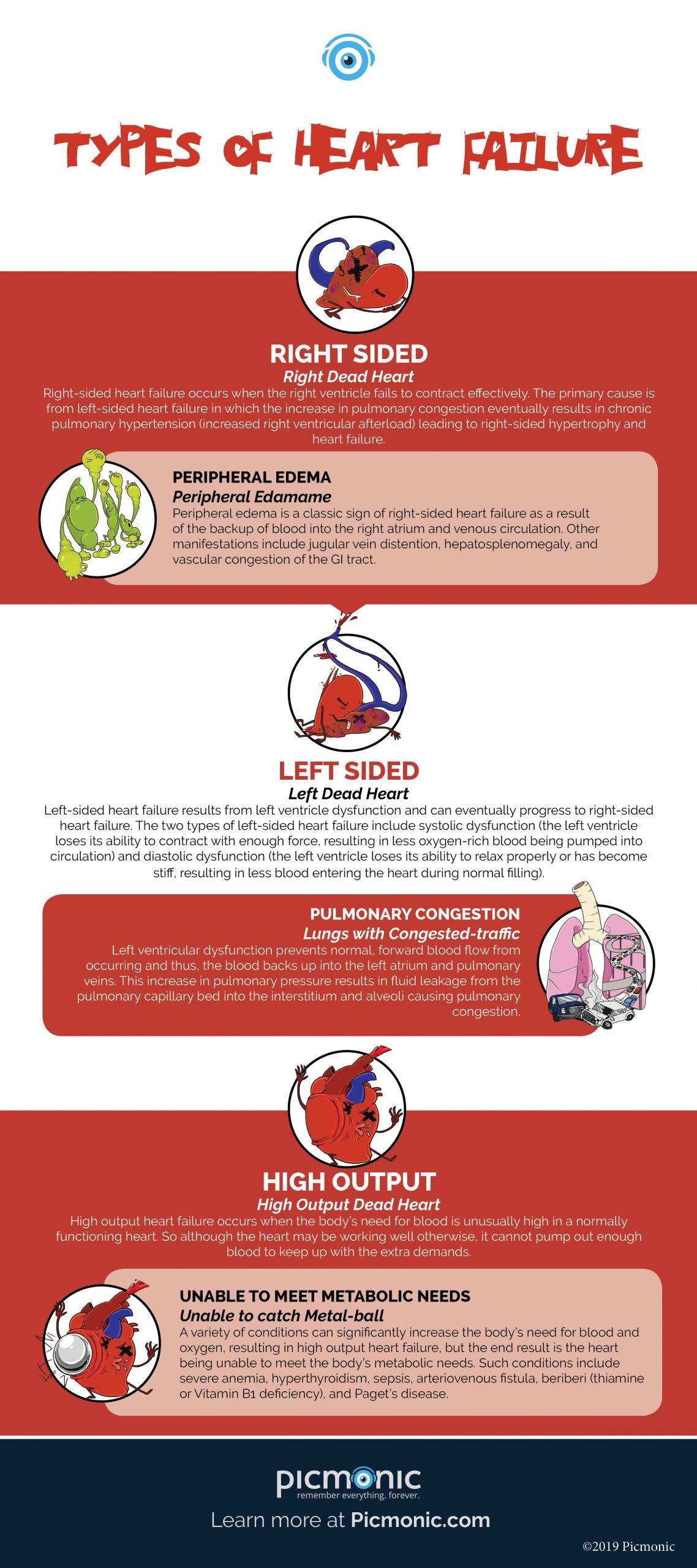 infographic-how-to-study-types-of-heart-failure-picmonic