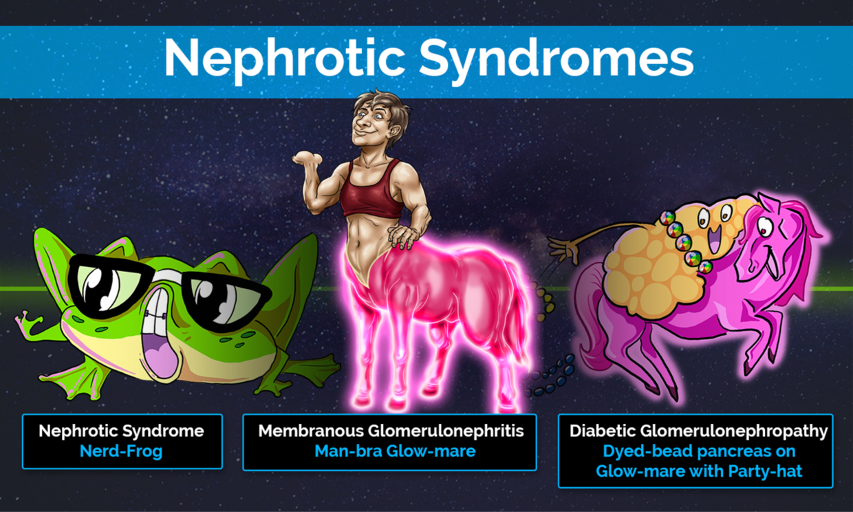 The cellular mechanisms leading to the various nephrotic and nephritic syndromes can be cumbersome and confusing.